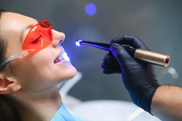 A dentist curing a dental sealant on an adult female patient's teeth with a blue light, while the patient wears red protective glasses.